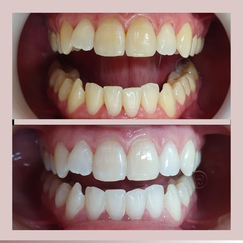 Mateo Villa.  ★★★★☆ - Customer result