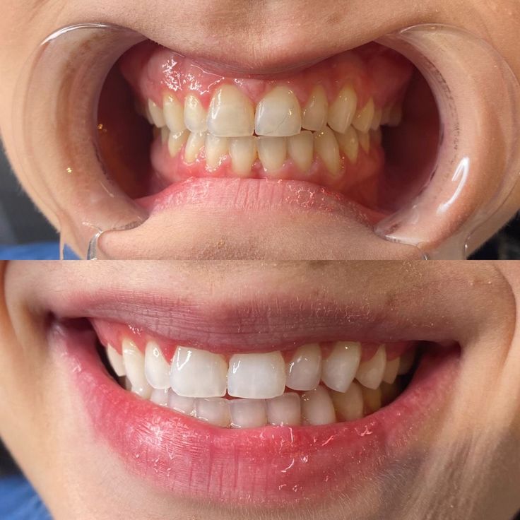 Martina21.  ★★★★☆ - Customer result