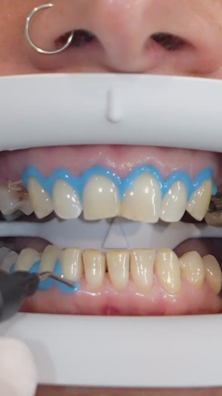 Cargar video: 